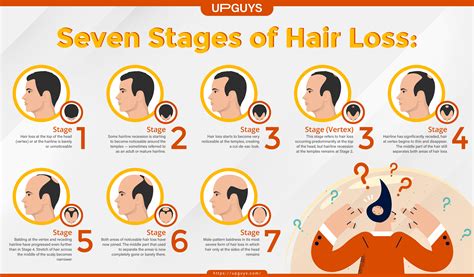 The Seven Stages Of Hair Loss Upguys