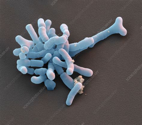Bifidobacterium Bacteria Sem Stock Image C0357894 Science Photo