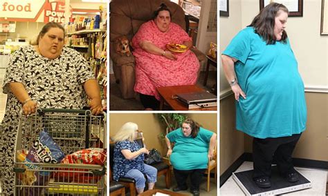 My 600lb S Susan Farmer Who Weighed 43st Loses Almost Half Her Body