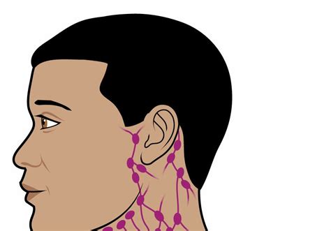 Lymph Nodes In Malay Lymph Nodes In Neck Artwork Stock Image