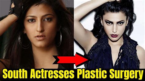 South Indian Actresses Before And After Plastic Surgery Tamil Actress
