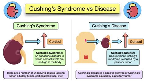 Cushings Syndrome Symptoms Causes Treatment Diagnosis Definitions