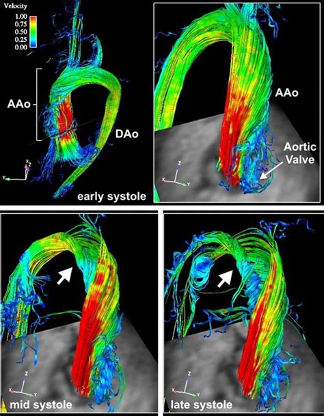 Helical Structure Improves Flow Modern Human Asknature