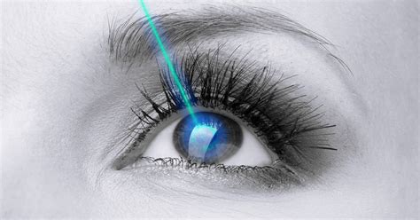 The Lasik Procedure How Lasik Eye Surgery Works