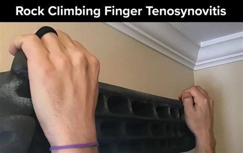 Rock Climbing Finger Tenosynovitis The Climbing Doctor