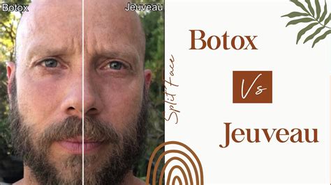 Jeuveau Jeuveau Vs Botox Split Face Study Youtube