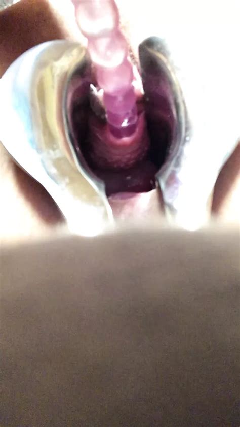 Urethal Anarstick Free Nxgx HD Porn Video 26 XHamster