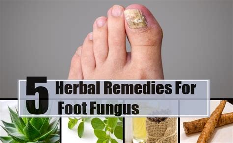 5 Amazing Herbal Remedies For Foot Fungus ~ Mzizi Mkavu