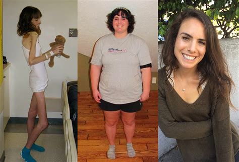 From Starving To 20000 Calories A Day This Student Battled The