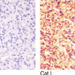 Immunohistochemical Analysis Of Cathepsin L Expression In Download Scientific Diagram