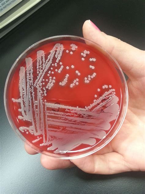 Staphylococcusaureusjpeg Microbiology Matters