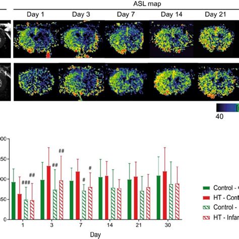 Longitudinal Monitoring Of The Mean Cerebral Blood Flow By Fair Mri