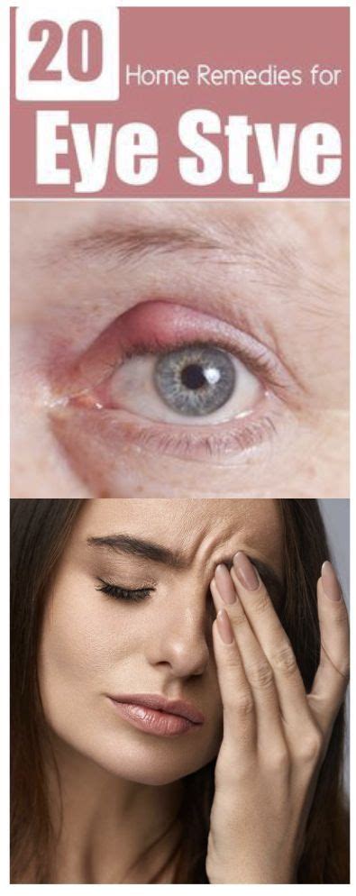 26 effective home remedies for eye stye checkthis remedies eye stye remedies skin care
