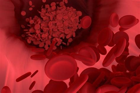 Punya Peran Penting Dalam Tubuh Ini Perbedaan Antara Pembuluh Darah