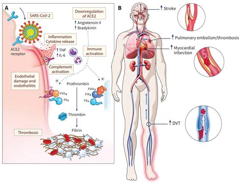 Anticipating And Managing Coagulopathy And Thrombotic Manifestations Of