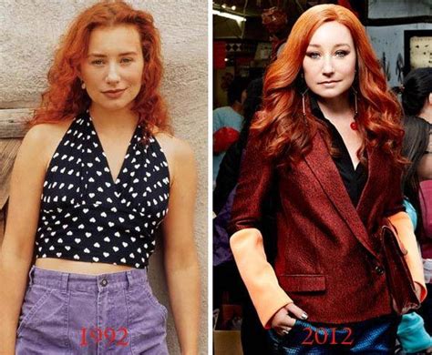 Tori Amos Plastic Surgery Before After Plastic Surgery Plastic Surgery Photos Cosmetic Surgery