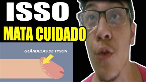 Glândula De Tyson RÉmedios Perigosos Que Podem Te Matar Glândula De Tyson SoluÇÕes Youtube