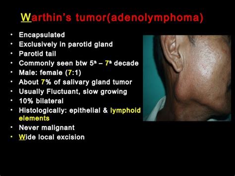 Benign And Malignat Tumors Of Salivary Gland