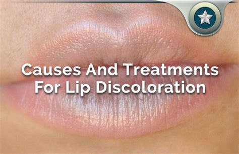 Discoloration Of Lips In African American Literature