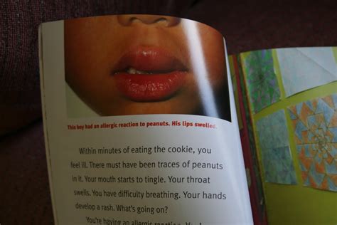 Get Allergy Wise Book Review Food Allergies