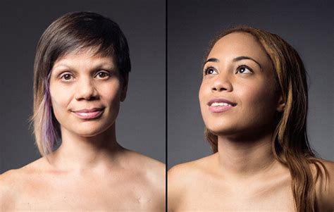 4 Women Show The Reality Of Their Mastectomies In Stunning Photos Huffpost Life