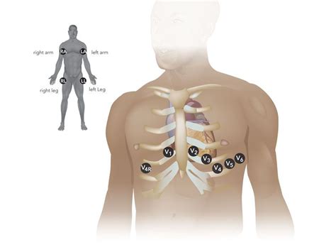 Ecg Lead Placement Nursing School Tips Nursing Students Felt Hearts