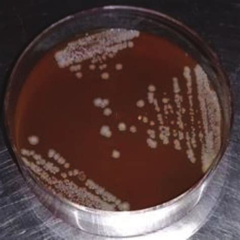 Prototheca Colonies On Blood Agar After 48 H Of Incubation Download