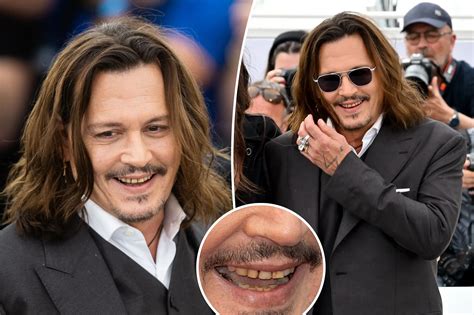 Johnny Depps Fans Notice His ‘rotting Teeth After He Held Back Tears