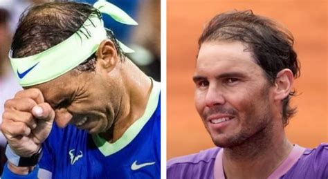 Rafael Nadal Hair Transplant Everything You Need To Know Wimpole Clinic
