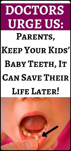 Doctors Urge Parents Keep Your Kids Baby Teeth Healthy Lifestyle