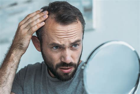 Possible Causes Of Hair Loss And Treatment Options
