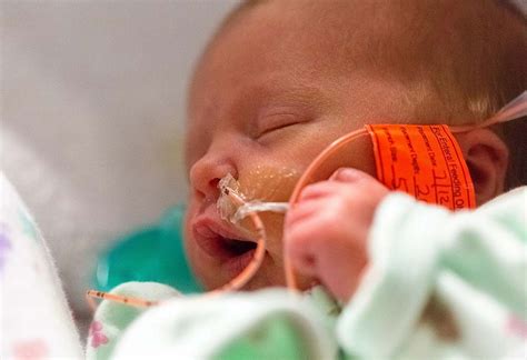 Feeding Tubes For Preemies Types And Usage And Risks