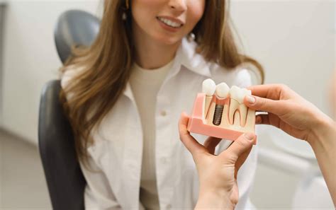 Razones Para Realizarse Implantes Dentales En La Clínica Deltadent Ca
