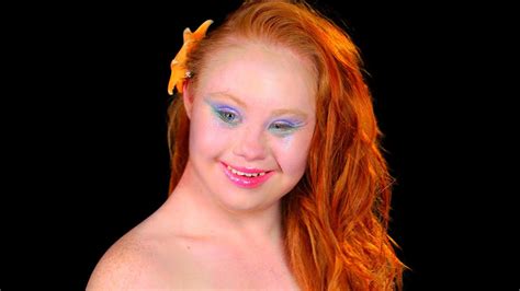 Beautiful Woman Down Syndrome Woman Down Syndrome Image And Photo Free Trial Isdudee