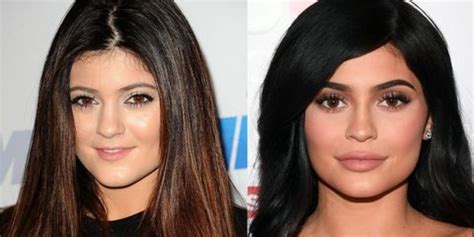 Kylie Jenner Sa Renversante Transformation Beauté