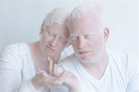 Albinism Photographs Yulia Taits Part Popsugar Beauty