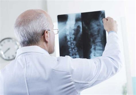 John Hall-Edwards e le prime radiografie mediche