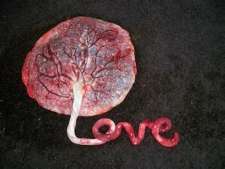 The risk of placenta accreta spectrum in women with in vitro whole blood transfusion reduces overall component transfusion in cases of placenta accreta. mamã inata: Medicina da Placenta