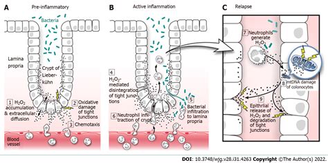 Evidence Based Pathogenesis And Treatment Of Ulcerative Colitis A