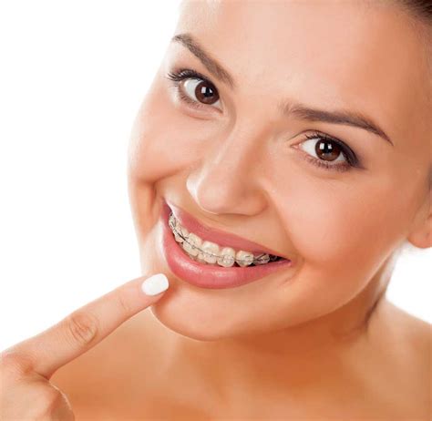 Clear Braces Treatment Scottish Orthodontics