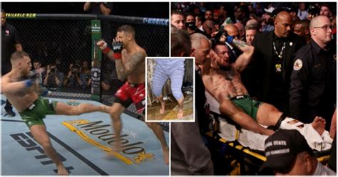 Conor Mcgregor Leg Break Ufc Star Shows Off Insane Leg Muscles Now