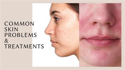 Common Skin Problems Modern Dermatology And Aesthetics