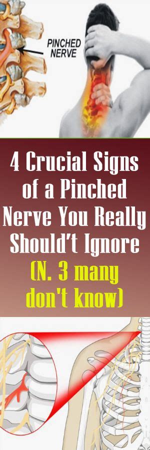 4 Crucial Signs Of A Pinched Nerve You Really Shouldt Ignore Pinched
