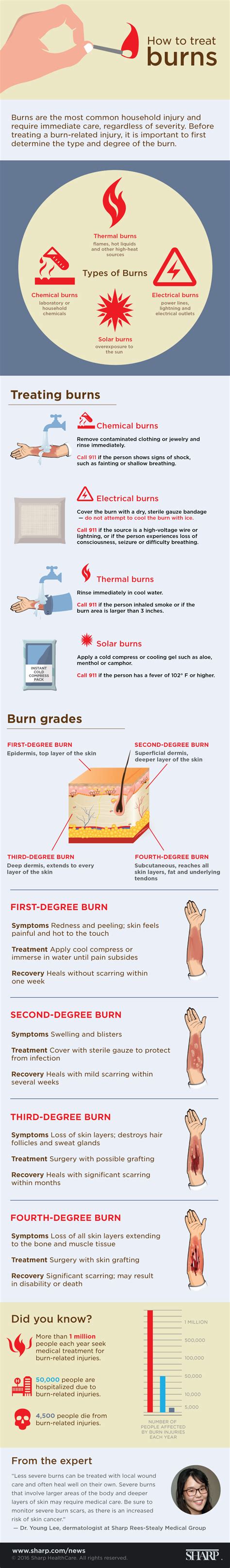 How To Treat Burns Infographic A Very Complete Infographic With The