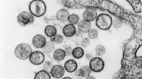 Setelah virus corona, disusul virus g4 alias virus flu babi baru, kini china berhadapan dengan virus tick borne. Heboh Hantavirus, Virus Mematikan yang Picu Kekhawatiran ...
