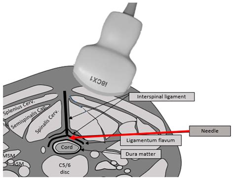 Tomography Free Full Text Direct Visualization Of Cervical