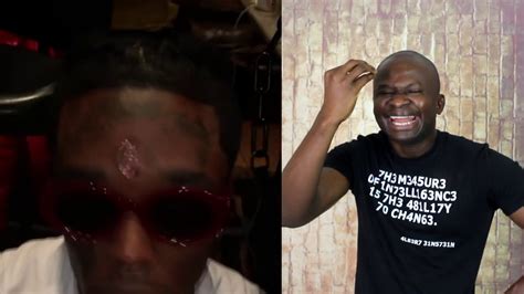 Rapper Lil Uzi Vert Implanted A 24 Million Diamond In His Forehead