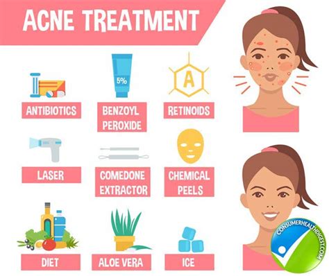 Acne Treatment How To Prevent Acne