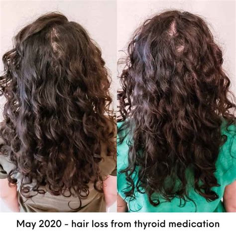 Hair Loss And The Curly Girl Method How To Address Thinning Curly Hair
