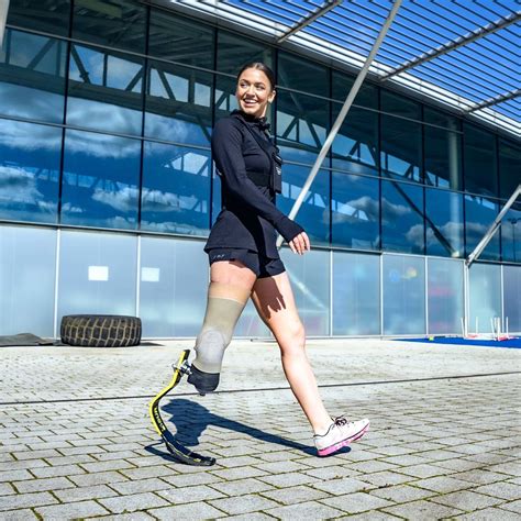 herts tiktok star is helping amputees in africa walk again inyourarea community